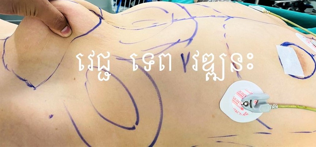 CÔNG TY TNHH Y TẾ HÀ ĐÔ - HADO MEDICAL