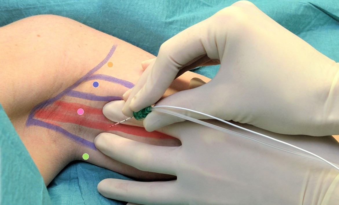 CÔNG TY TNHH Y TẾ HÀ ĐÔ - HADO MEDICAL