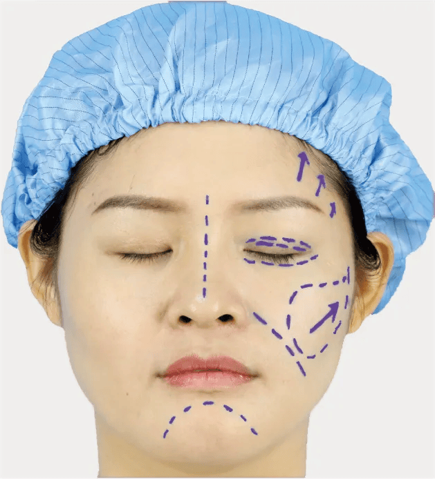 CÔNG TY TNHH Y TẾ HÀ ĐÔ - HADO MEDICAL