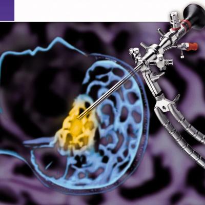 Dụng cụ phẫu thuật nội soi Sọ Não