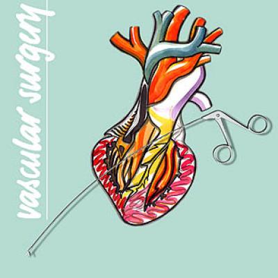 Dụng cụ nội soi phẫu thuật tim mạch